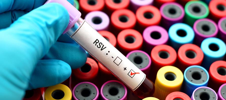 RSV Testing Clinic Near Me in Frederick, MD RSV Testing Clinic Near Me in Frederick, MD